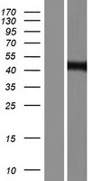 ZDHHC7 Human Over-expression Lysate