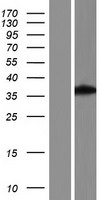 ENDOGL1 (EXOG) Human Over-expression Lysate