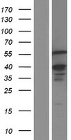 ETV3 Human Over-expression Lysate