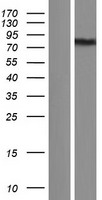 EXOC7 Human Over-expression Lysate