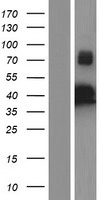 IKK gamma (IKBKG) Human Over-expression Lysate