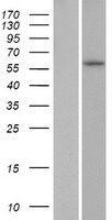 ZNF286B Human Over-expression Lysate