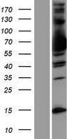 MX1 Human Over-expression Lysate