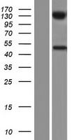 UGT2B10 Human Over-expression Lysate