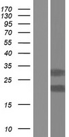 TMX2 Human Over-expression Lysate