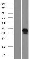 FAM76A Human Over-expression Lysate