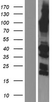 SYCE1 Human Over-expression Lysate