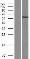 PPP3CB Human Over-expression Lysate