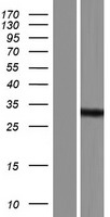 RNASEH2B Human Over-expression Lysate
