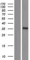 ACBD4 Human Over-expression Lysate