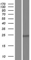 CEP27 (HAUS2) Human Over-expression Lysate