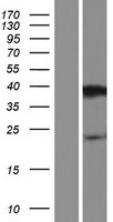 PRR20D Human Over-expression Lysate