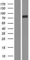 Lysyl tRNA synthetase (KARS) Human Over-expression Lysate