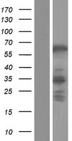 ABLIM2 Human Over-expression Lysate