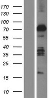 ABLIM2 Human Over-expression Lysate