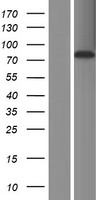 ABLIM2 Human Over-expression Lysate