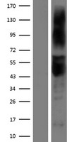 ART3 Human Over-expression Lysate
