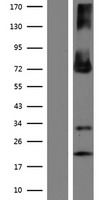 ENTPD4 Human Over-expression Lysate