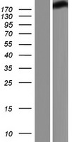 BRG1 (SMARCA4) Human Over-expression Lysate