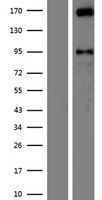 AUTS2 Human Over-expression Lysate