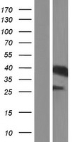Haptoglobin (HP) Human Over-expression Lysate