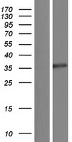 PPP6C Human Over-expression Lysate