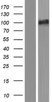 SMEK2 (PPP4R3B) Human Over-expression Lysate