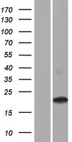 CD300LD Human Over-expression Lysate
