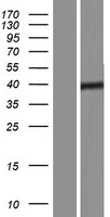 SBK2 Human Over-expression Lysate