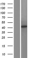 ACAT1 Human Over-expression Lysate