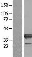 Apolipoprotein E (APOE) Human Over-expression Lysate