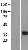 Arginase 1 (ARG1) Human Over-expression Lysate