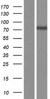 CPT2 Human Over-expression Lysate