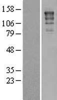 XPG (ERCC5) Human Over-expression Lysate