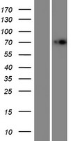 IDUA Human Over-expression Lysate