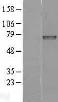 Iduronate 2 sulfatase (IDS) Human Over-expression Lysate