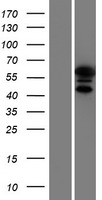 Cytokeratin 9 (KRT9) Human Over-expression Lysate