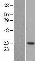 Nucleoside phosphorylase (PNP) Human Over-expression Lysate
