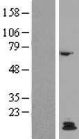 Parathyroid Hormone (PTH) Human Over-expression Lysate
