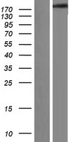 SCN4A Human Over-expression Lysate