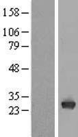 Triosephosphate isomerase (TPI1) Human Over-expression Lysate