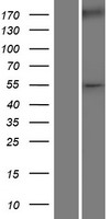 Wilms Tumor Protein (WT1) Human Over-expression Lysate