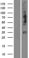 OPN1MW Human Over-expression Lysate