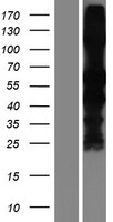 Retinal S antigen (SAG) Human Over-expression Lysate