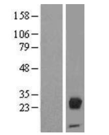 Orosomucoid 2 (ORM2) Human Over-expression Lysate
