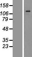 CD11b (ITGAM) Human Over-expression Lysate