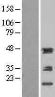 Aminoacylase 1 (ACY1) Human Over-expression Lysate