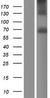 Acetylcholinesterase (ACHE) Human Over-expression Lysate