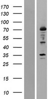12 Lipoxygenase (ALOX12) Human Over-expression Lysate