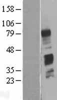 C4BPB Human Over-expression Lysate